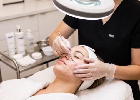 Acne Treatment